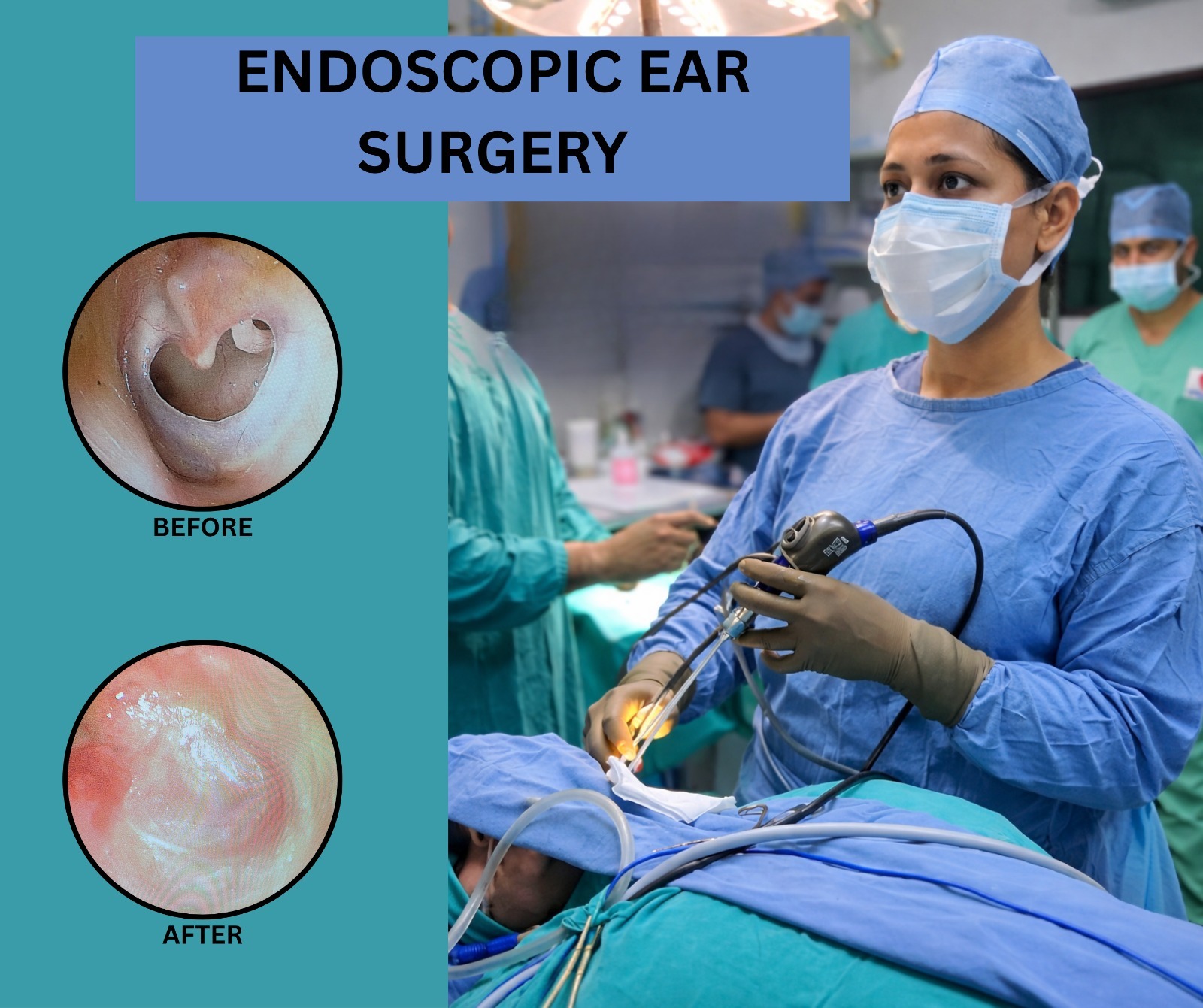 Ear Surgery